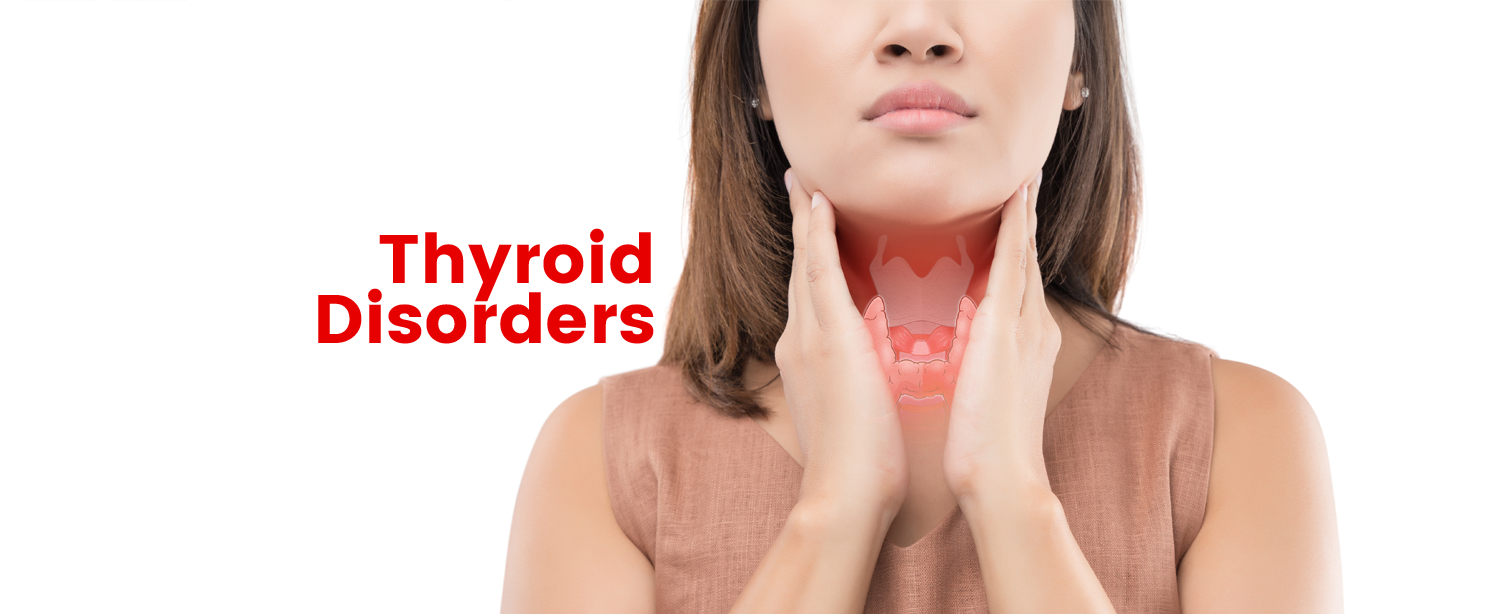 Common Thyroid Disorder & Symptoms | KDAH Blog