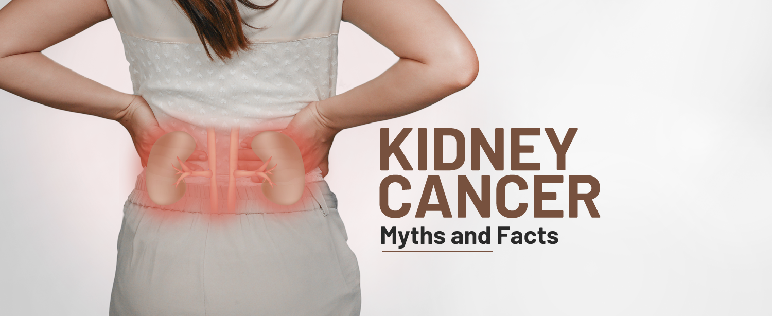 Kidney Cancer Myths and Facts