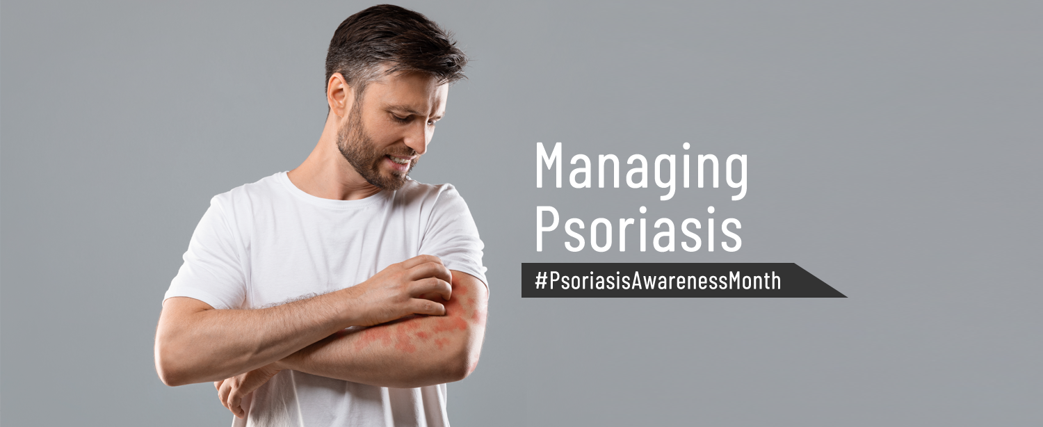 Managing Psoriasis
