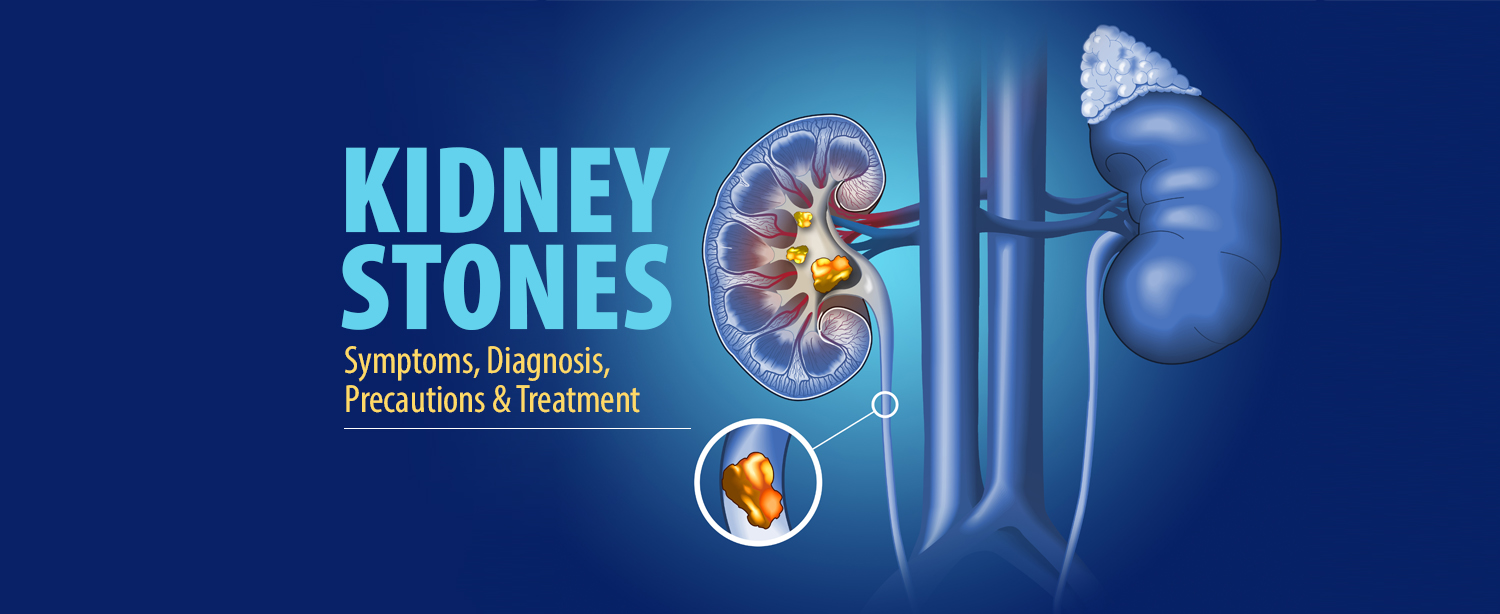 https://www.kokilabenhospital.com/blog/wp-content/uploads/2023/03/Kidney-stones.jpg