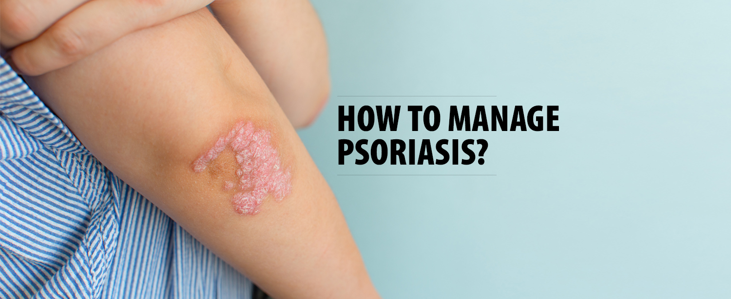 How to manage Psoriasis