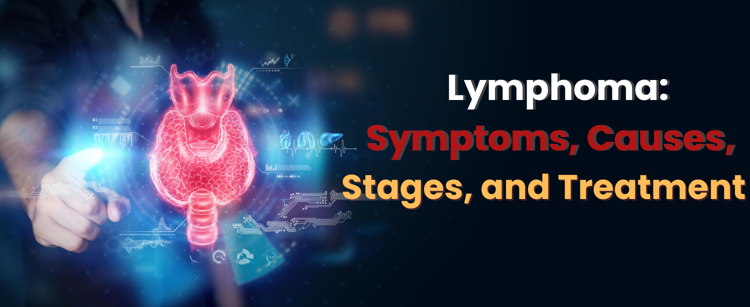 lymphoma​