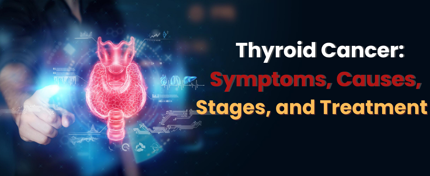 thyroid cancer​